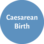 c-section birth button